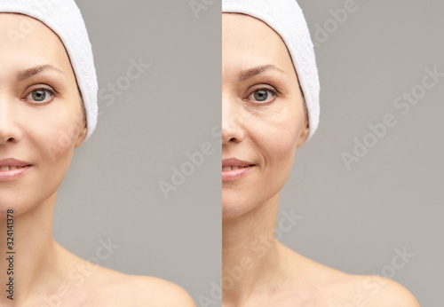 Pretty mature girl. Before and after portrait. Anti wrincle healthy therapy photo