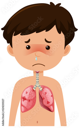 Sick boy from coronavirus with pneumonia