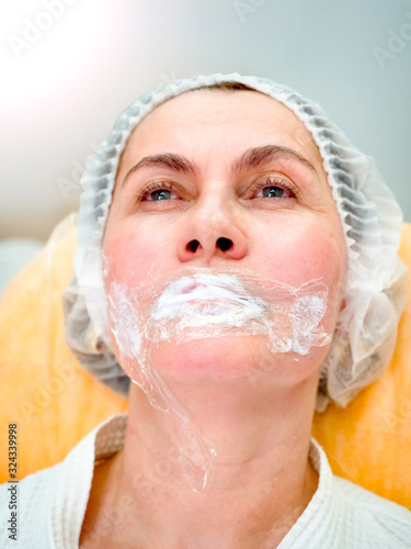 Applying anesthesia before enlarging lips at beauty salon. Portrait of a mature woman lying on a couch before a cosmetic procedure.
