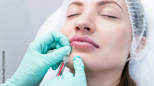 The young beautician doctor preparing to making injection in female lips. The doctor cosmetologist makes lip augmentation procedure.