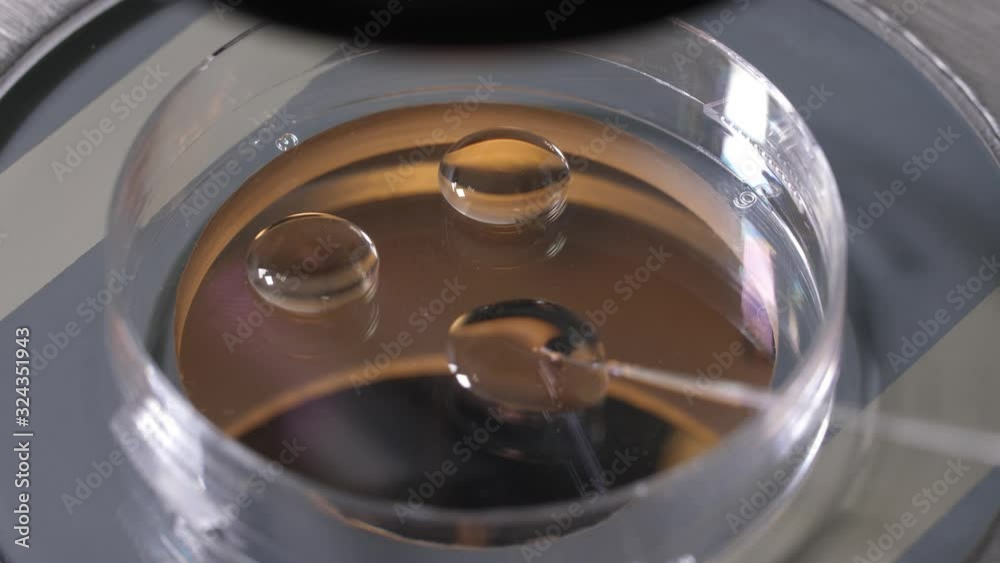 Close-up of petri dish with drops of cryoprotectant under microscope during work of embryologist in medical laboratory. Scientist using pipette to place embryos in cryoprotectant before vetrification