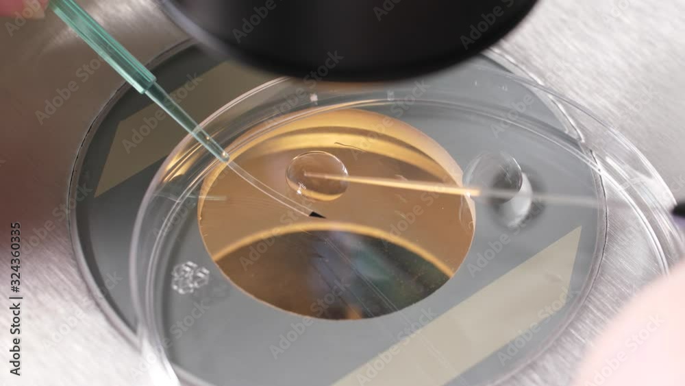Close-up of filigree laboratory manipulation, moving of embryo from cryoprotectant to special medical tool for subsequent freezing. Specialist using pipette to take embryo and place in liquid nitrogen