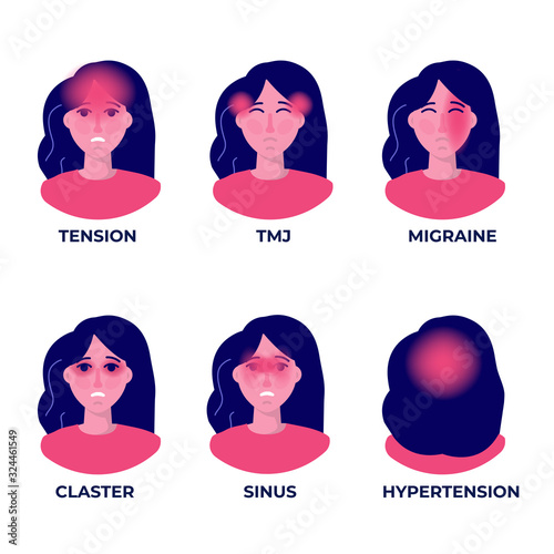 Headache types on different area of patient head set.  Vector illustration.