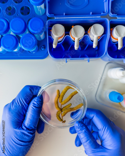 Allergic diagnosis. Catkins of hazel, a very allergenic pollen in the laboratory.