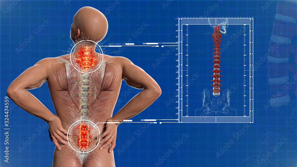Anatomical vision back pain. Spine anatomy. 3D illustration. Stock ...