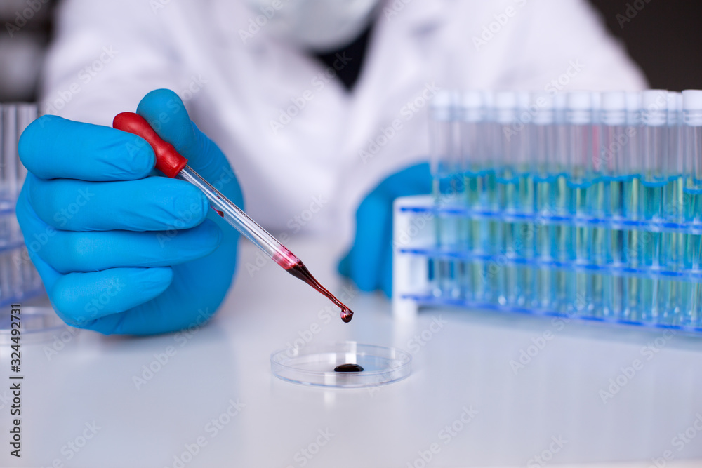 Laboratory blood tests. Human hand in rubber glove dripping a gore by pipette in petri dishes, close up, selective focus. Laboratory blood tests. Human hand in rubber glove dripping a gore by pipette in petri dishes, close up, selective focus.