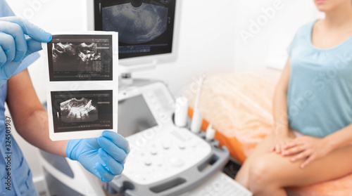 Doctor holding in his hands results of a transvaginal ultrasound of ovaries. Gynecology © Peakstock