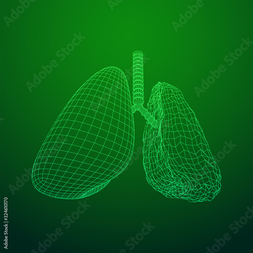 Healthy and sick lung with trachea bronchi internal organ human. Pulmonology medicine science technology concept. Wireframe low poly mesh vector illustration
