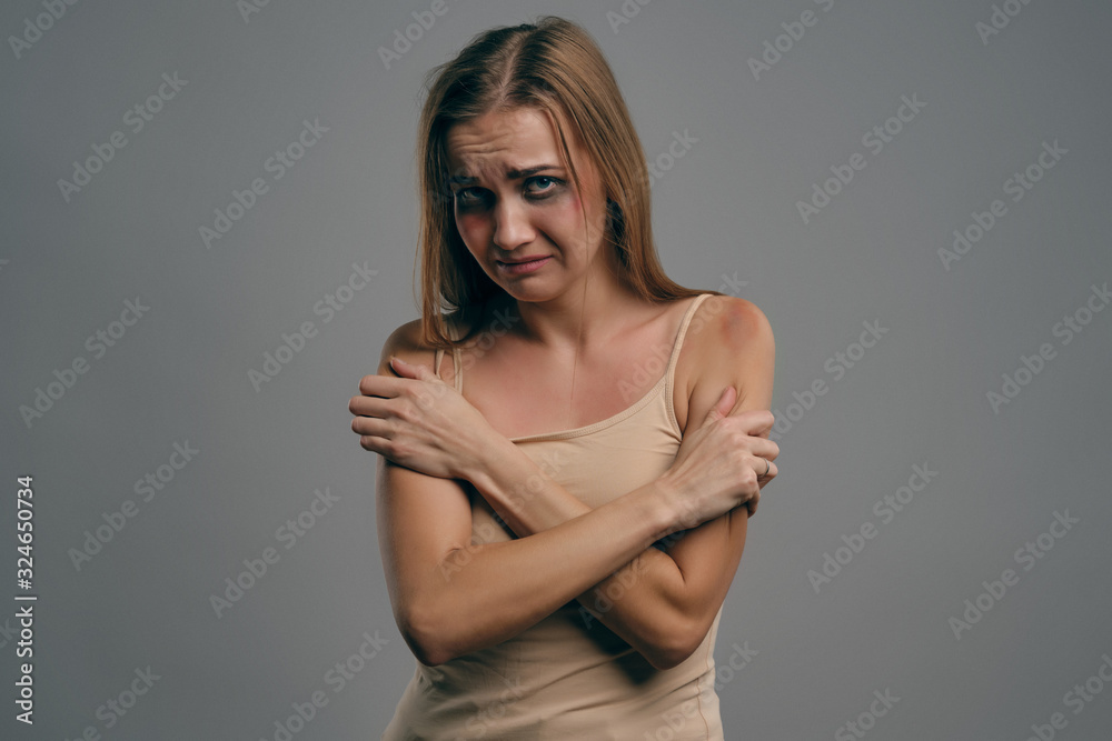 Blonde girl with bruises on her face, pressed her hands to chest, posing on gray studio background. Domestic violence, abuse. Close-up, copy space. Blonde girl with bruises on her face, pressed her hands to chest, posing on gray studio background. Domestic violence, abuse. Close-up, copy space.