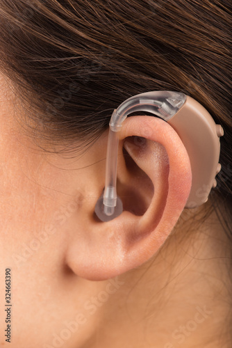 Картината върху платно A girl with a hearing aid