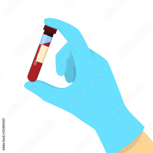 Hand in medical glove holding a blood sample in glass tube