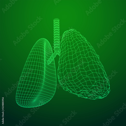 Healthy and sick lung with trachea bronchi internal organ human. Pulmonology medicine science technology concept. Wireframe low poly mesh vector illustration