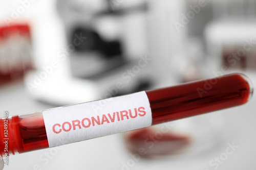 Test tube with blood sample and label CORONA VIRUS in laboratory, closeup