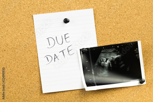 Due date text on white paper sticky note with an ultrasound photo of baby fetus. Expecting, preparing for a childbirth in the last third trimester od pregnancy.