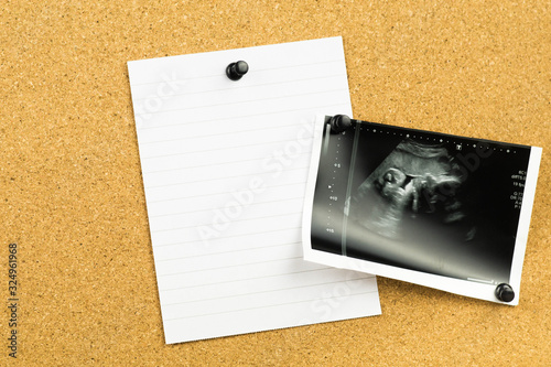 Obraz na płótnie blank note on a cork card board with an ultrasound photo of baby fetus - announcing pregnancy message on paper w salonie