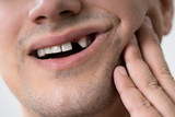 Man Having Toothache