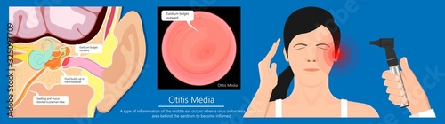 Acute Otitis Media concept. Ear infection medical diagnoses