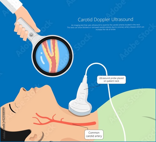 Coronary artery disease CAD diagnosis treatment
