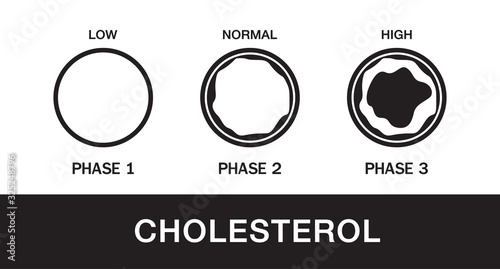 Cholesterol in artery, health risk , vector design
