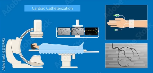 Cardiac catheter ablation Atrial fibrillation minimally invasive procedure