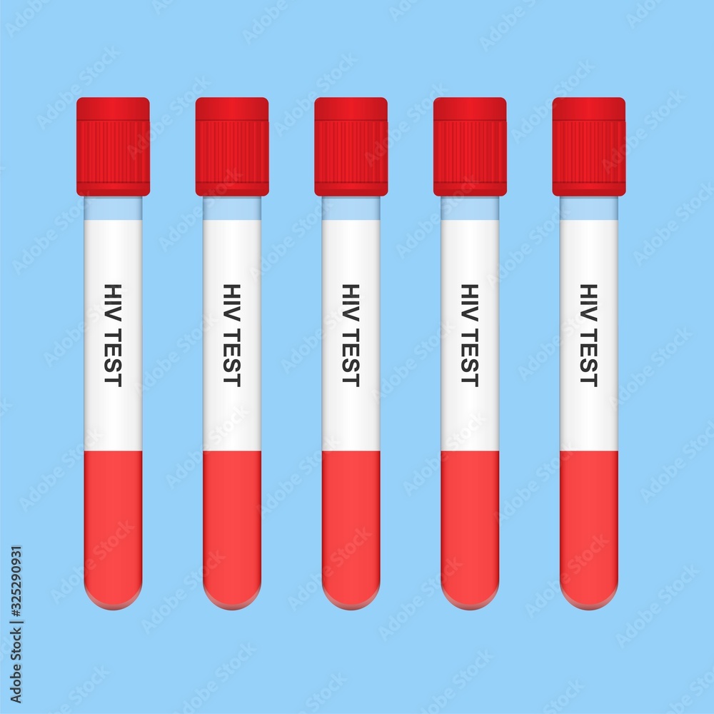 HIV Test Result with Vacutainer Contain Lab Diagnose Sexual Transmission HIV Test Result with Vacutainer Contain Lab Diagnose Sexual Transmission