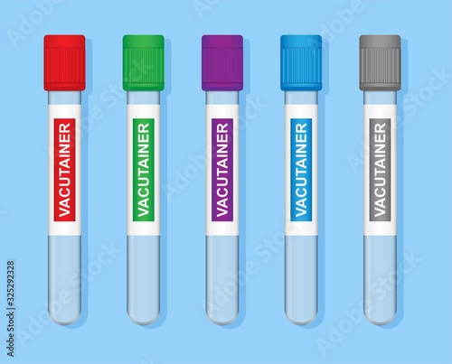 Vacutainer Tube Many Type HIV Contain Diagnose