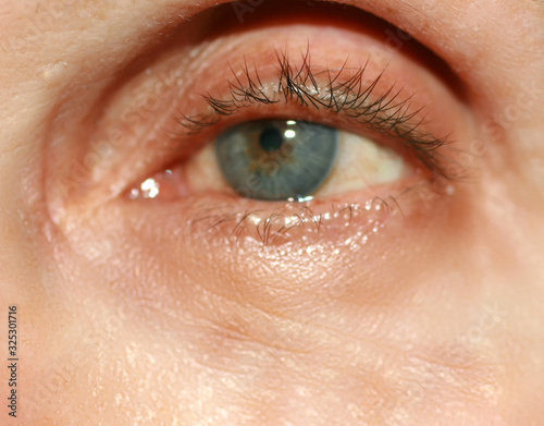 Fototapeta Naklejka Na Ścianę i Meble -  Wrinkles under the eyes. Wrinkles on the skin of the face. Flabby eyelids