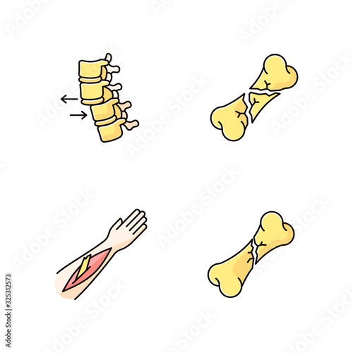 Body part injuries RGB color icons set. Spinal vertebra, spine dislocation. Open fracture. Broken bones. Medical condition. Accident. Treatment. Isolated vector illustrations