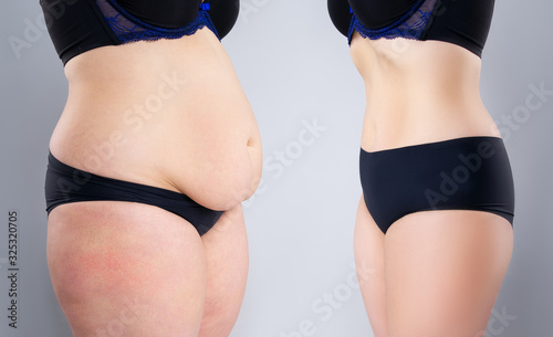 Woman's belly before and after weight loss on gray background