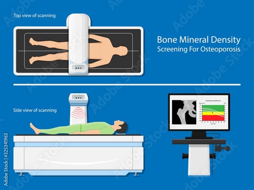 Bone mineral density BMD osteoporosis dual energy X-ray absorptionmetry adult disease equipment medical clinic central DXA pain radiography hospital fragility risk examine
