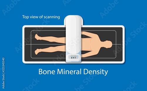 Bone mineral density BMD osteoporosis dual energy X-ray absorptionmetry adult disease equipment medical clinic central DXA pain radiography hospital fragility risk examine