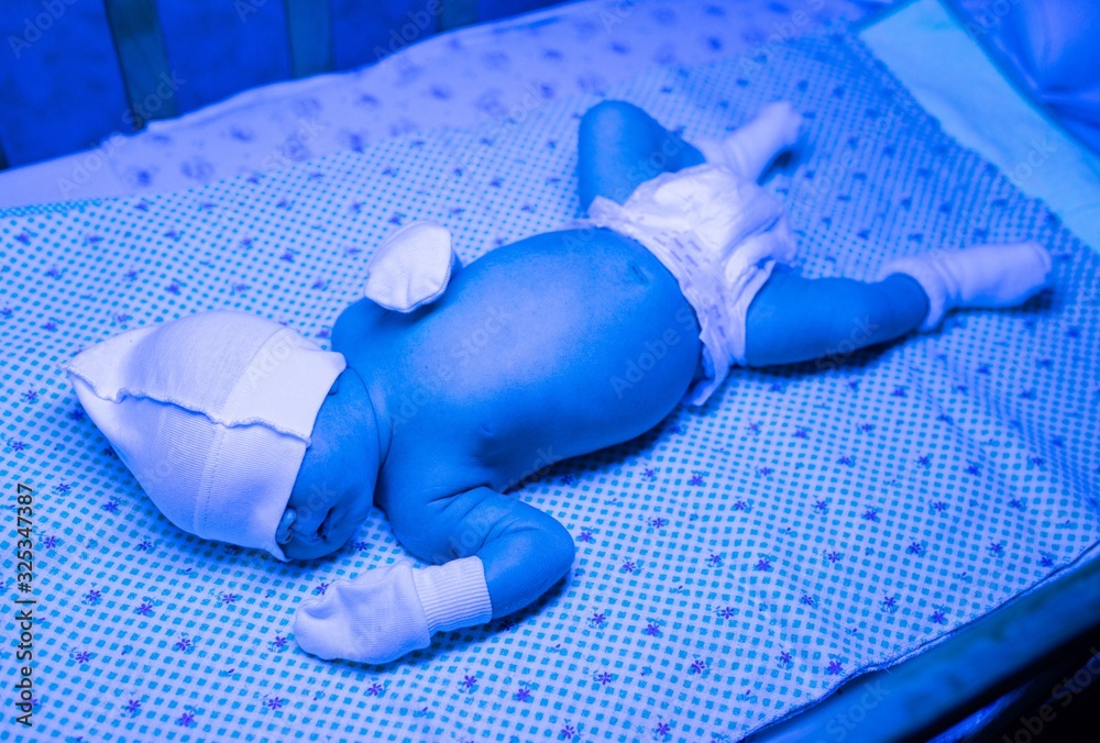 Newborn having a treatment for jaundice under ultraviolet light, Baby