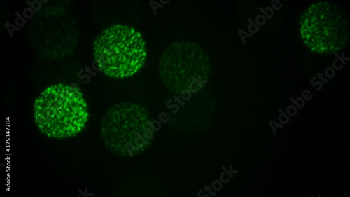 Coronavirus COVID-19  disease COVID-19 outbreak illustration