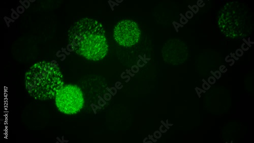 Coronavirus COVID-19  disease COVID-19 outbreak illustration