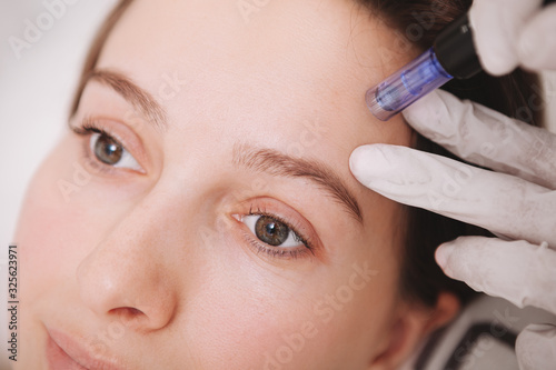 Close up of a young woman receiving microinjections in her forehead, getting mesotherapy treatment by beautician photo