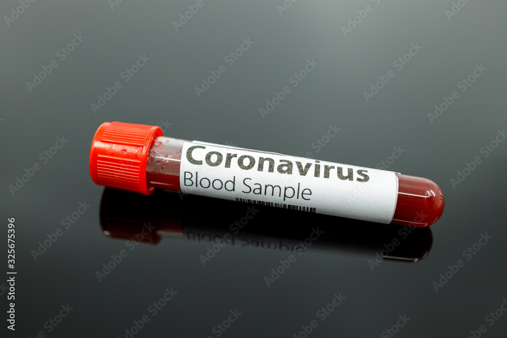 Test tube with blood sample for the new rapidly spreading Coronavirus that originated in Wuhan, China. Coronavirus blood test tube on black background with reflection and copy space Test tube with blood sample for the new rapidly spreading Coronavirus that originated in Wuhan, China. Coronavirus blood test tube on black background with reflection and copy space