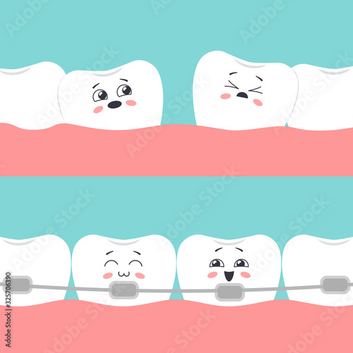The concept of orthodontic treatment. Distorted teeth Before and straight teeth with braces After. Vector illustration