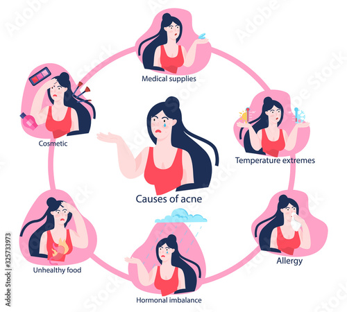 Acne causes infographics. Young woman with pimple on skin.