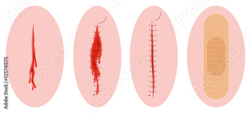 Set of vector illustration of physical body injury. Isolated cartoon style