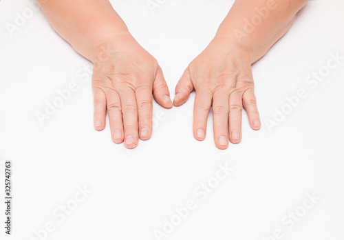 Dry skin with wrinkles on the hands of an elderly woman, white background, isolate. Fragility of blood vessels, vitamin deficiency, copy space photo