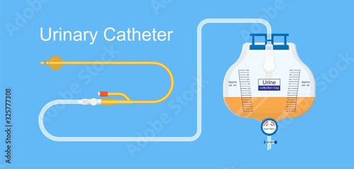 Urine bag medical treatment drainage bladder rubber flexible body infection bacteria output measure tract toilet leg relieve cancer device calculi vesical problem anatomy sterile surgical urethra