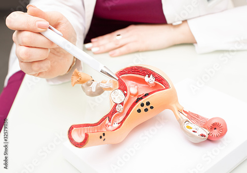 Fotótapéta Gynecologist showing uterine structure on a uterus model