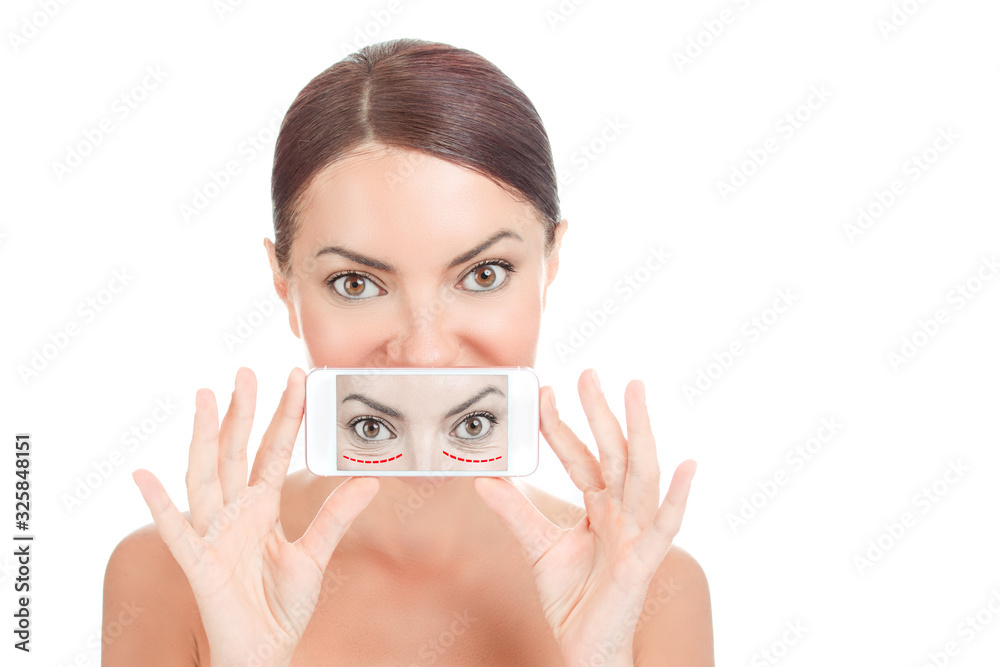 Before and after blepharoplasty. Before and after blepharoplasty.