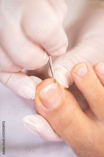 Toenail cleaning in close up