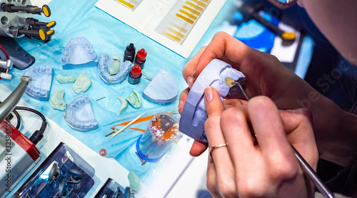 Making models of patients ' jaws. Layouts for the production of dental prostheses. Correction of bite. Dentistry. The installation of implants. Orthodontics. Training of dental technicians.