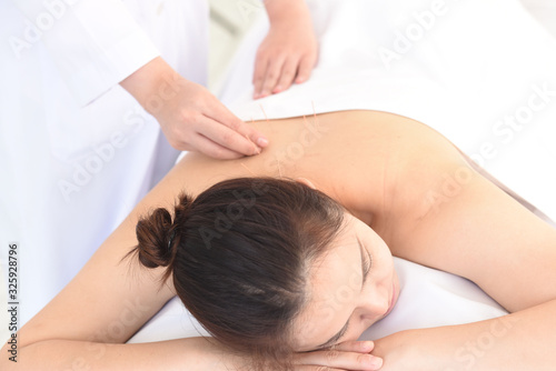 Acupuncture treatment therapy by doctor
