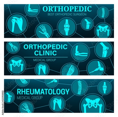 Rheumatology and orthopedic medical clinic vector banners with joints and bones anatomy. MRI and CT scans of arthritis pain diagnostics with leg, hand, knee and spine, foot, pelvis, shoulder and elbow