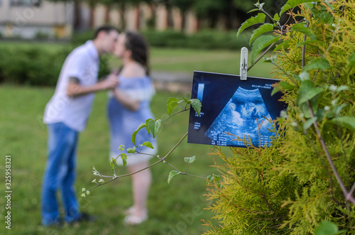 Ultrasound picture with an unborn child hanging on a tree on a clothespin against the background of kissing future parents