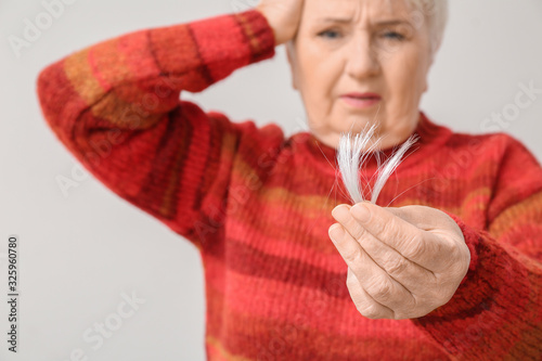 Senior woman with hair loss...