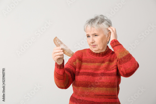 Senior woman with hair loss...